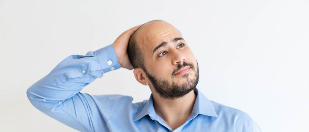 male pattern baldness